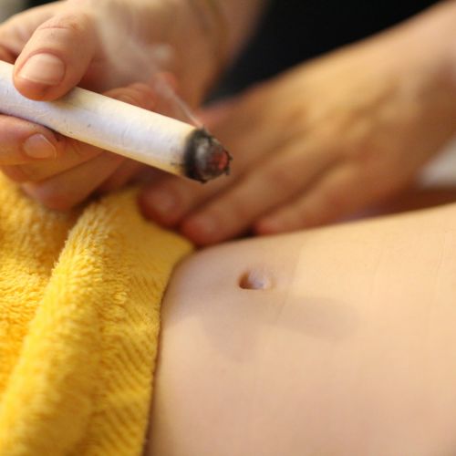 LA MOXIBUSTION