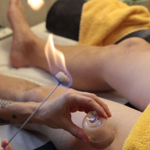 La VENTOUSE Thérapie